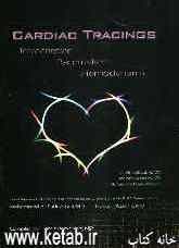 Cardiac tracings intracardiac pacemaker hemodynamic