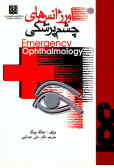 اورژانسهای چشم پزشکی