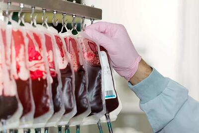 محققان: یک آنزیم باکتری روده می‌تواند دستیابی به خون همگانی را ممکن کند