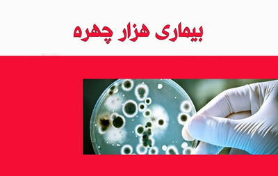 بیماری هزار چهره‌ای که همه افراد را تحت تأثیر قرار می‌دهد