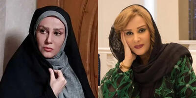 تغییر چهره این بازیگر ایرانی سوژه شد؛ همه مدل جراحی زیبایی روی صورتش انجام داده! - چی بپوشم