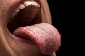 آیا رنگ کبود زبان علامت بیماری خطرناکی است؟