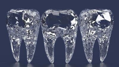 صفر تا صد ایمپلنت دندان در ۱۴۰۳ (ایمپلنت دیجیتالی و...)