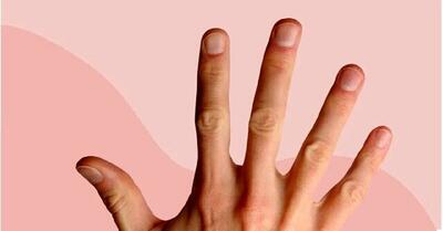 ابتلا به سرطان از ناخن‌های دست قابل تشخصی است