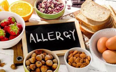 آلرژی غذایی؛ این ۶ خوراکی حساسیت‌زا هستند