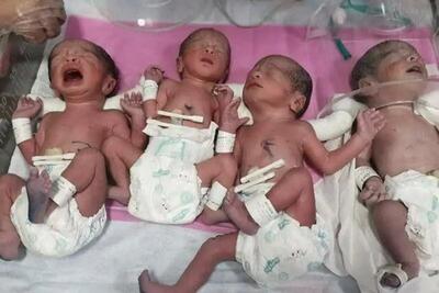 تولد چهارقلوهای مشهدی در هفته ۳۳ بارداری