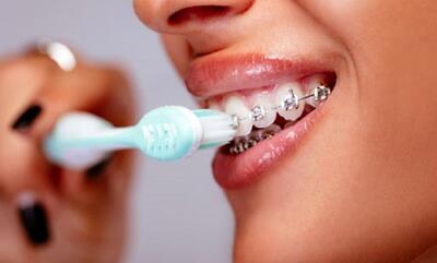 درمان پوسیدگی دندان در خانه + علائم