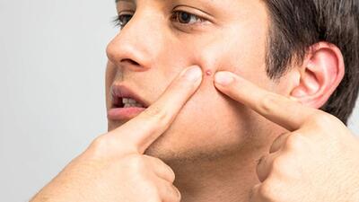 به جوش‌های این ناحیه صورت دست نزنید + فیلم