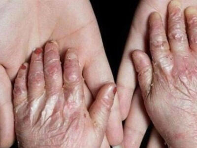 ترامپ ۲۰۲۴: کودکان ایرانی در محاصره تحریم‌ها - دیپلماسی ایرانی