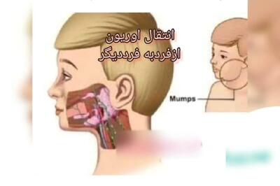 اوریون چیست؟ + فیلم