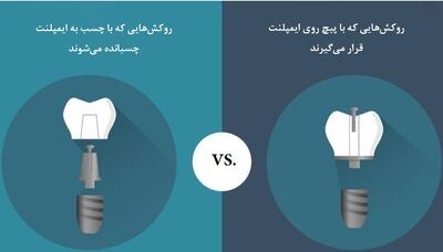 مقایسه روکش ایمپلنت پیچی و چسبی