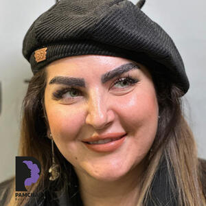 کاشت ابرو طبیعی پرتراکم برای زنان و مردان+عکس