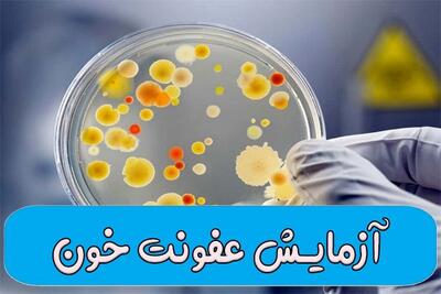 آزمایش عفونت خون به چند دسته تقسیم می شود؟ [ 11 آزمایش مهم ] |  انصاف نیوز