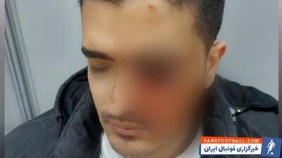 وضعیت هواداران مصدوم پرسپولیس از زبان مادرانشان - پارس فوتبال