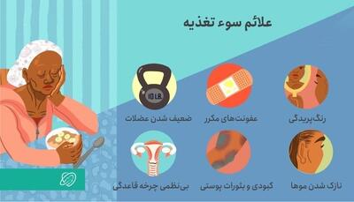 اینفوگرافی/ علائم سوتغذیه چیست؟ | اقتصاد24
