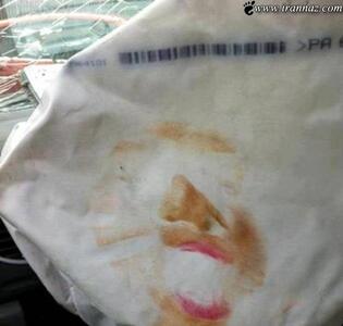 سوژه امروز | وقتی ایربگ در صورت یک دختر خانم باز بشه (تصویری)