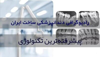 رادیوگرافی دندانپزشکی: پیشرفته‌ترین نوع تصویربرداری
