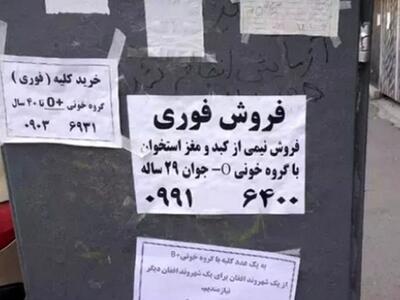 نقل قول «کلیه فروشی» از طرف یک نماینده دوباره جنجالی شد