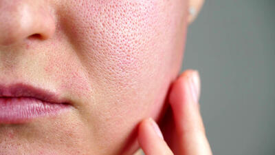 چگونه پوستی صاف و بدون منافذ داشته باشیم؟