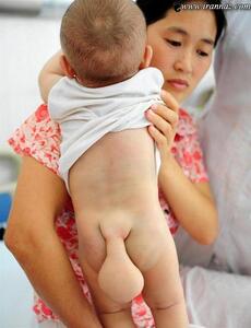 سوژه امروز | عکس ترسناک از یک پسر دم دار که در چین متولد شده