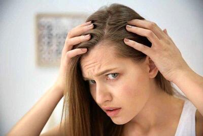 چرا موی جلوی سر خانم‌ها می‌ریزد؟