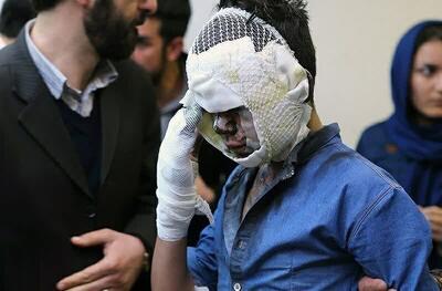 آمار مصدومان حوادث چهارشنبه سوری به ۸۸۱ نفر رسید