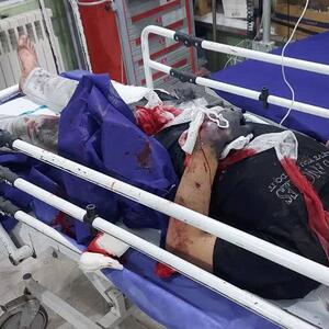 ۱۹۵ نفر در حوادث چهارشنبه‌سوری اردبیل مصدوم شدند