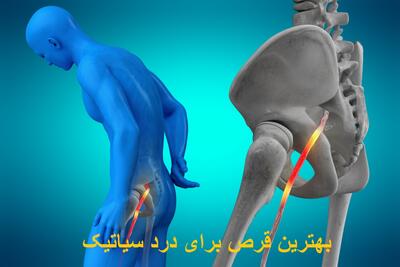 بهترین قرص برای کاهش و درمان درد سیاتیک کمر و پا | برای درد سیاتیک چه بخوریم؟