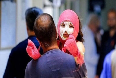 آمار حوادث چهارشنبه‌سوری اردبیل به ۱۴۸ نفر رسید