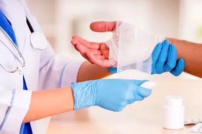 اقدامات اولیه در مواجهه با سوختگی: راهنمای جامع و دقیق