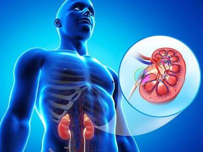 علائم رایج بیماری کلیوی کدام است؟