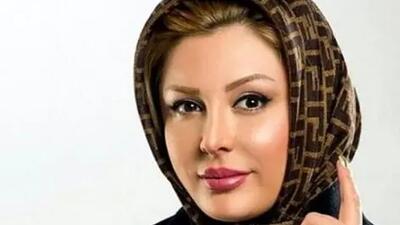 پشت پرده جنجالی عمل های زیبایی نیوشا ضیغمی لو رفت / کوبیدم از نو ساختم !