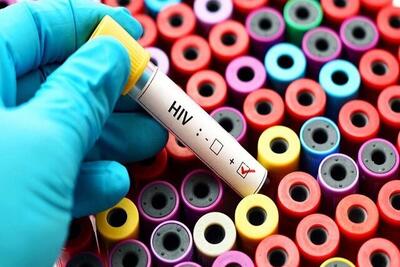 هشدار سازمان ملل: ممکن است روزانه ۲۰۰۰ عفونت HIV جدید در سراسر جهان رخ دهد