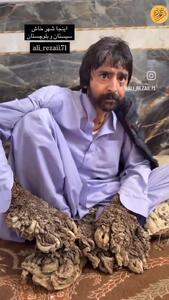 مرد درختی سیستان و بلوچستان را دریابید!