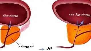 کپسول پروترال برای چیست؟ + تداخل دارویی با داروهای اعصاب