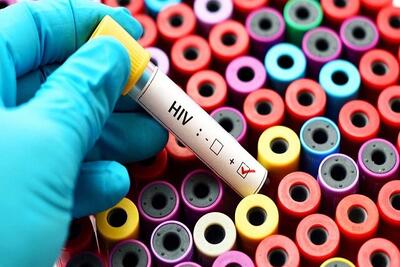 خطر شیوع ویروس HIV جدید در جهان بالا گرفت