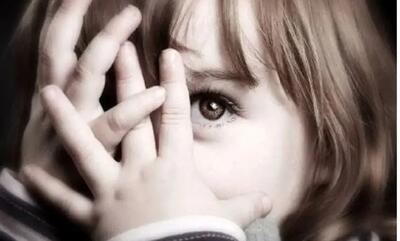 عکس/ بلای وحشتناکی که این مرد سر صورتش آورد تا شبیه آدم نباشد
