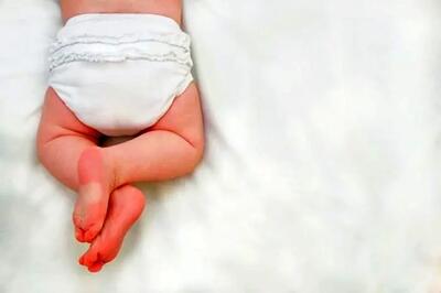 کودک وحشتناکی که دو سر روی هم دارد / عکس