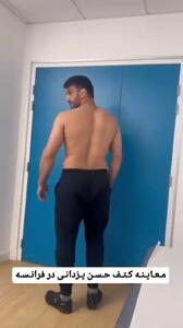 شرایط حسن یزدانی پس از جراحی کتف با ظاهری کاملا متفاوت