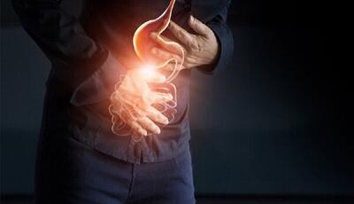 هر آنچه باید درباره رفلاکس معده بدانید - سبک ایده آل