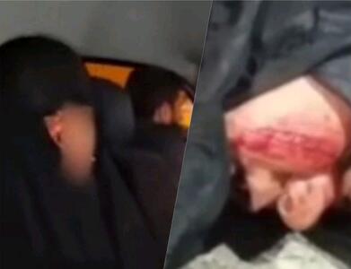 افشای اقدام عجیب متحصنین مقابل مجلس: این زن، صورت خود را دیشب پاره کرد تا بگوید فراجا با او برخورد فیزیکی کرده است