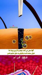 وقتی خالکوبی می کنید واقعا چه اتفاقی می افتد؟ + فیلم
