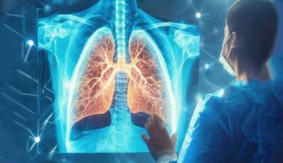 افزایش خطر مرگ در میان افراد مبتلا به آرتروز و بیماری انسداد ریوی