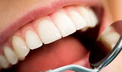 چه زمانی برای سنگ لوزه به پزشک مراجعه کنیم؟