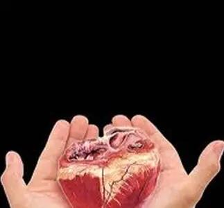 انجام دومین عمل پیوند عضو در سال جدید در خوزستان