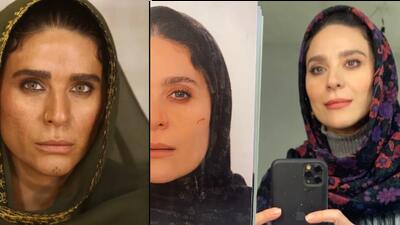 تصویر روز | تغییر چهره باورنکردنی «سحر دولتشاهی» همسر سابق همایون شجریان | گلی شی