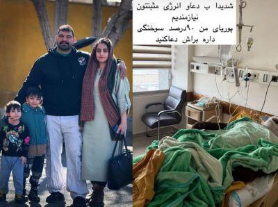 حادثه وحشتناک برای پوریا پورمراد، بلاگر مشهور اینستاگرام