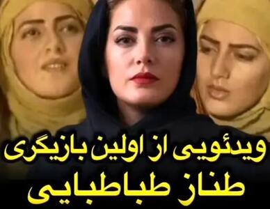 چهره قبل عمل و اولین تجربه بازیگری طناز طبابایی+ ویدیو