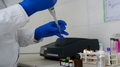 آزمایش خون؛ جدیدترین روش تشخیص آلزایمر و ارزیابی پیشرفت بیماری