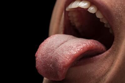 سوزش زبان نشانه چیست؟ - سبک ایده آل